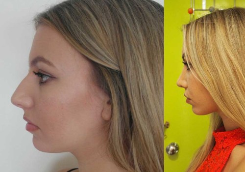 Should i feel guilty for wanting plastic surgery?