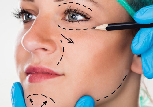 What is the correct term for plastic surgery?