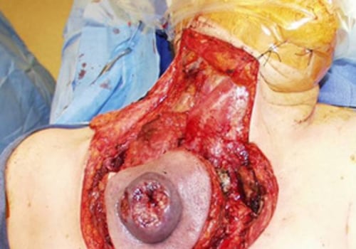 What happens during plastic surgery?