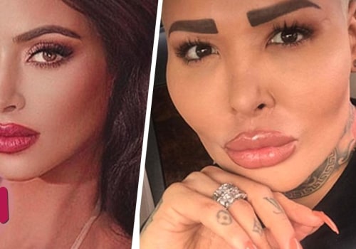 How many people disagree with plastic surgery?